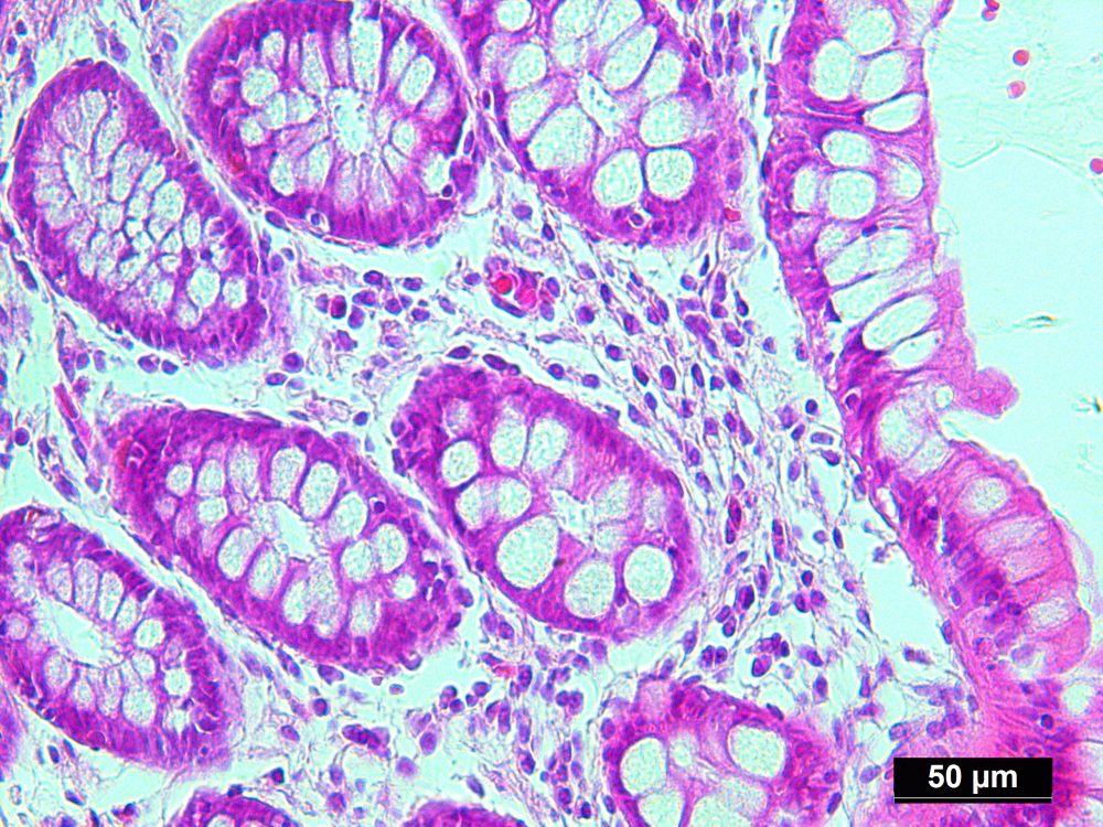 Human Colon Tissue Normal Ffpe Sections