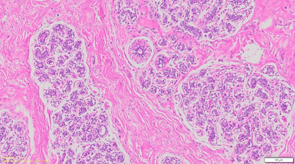 Human Breast Tissue Normal FFPE Sections