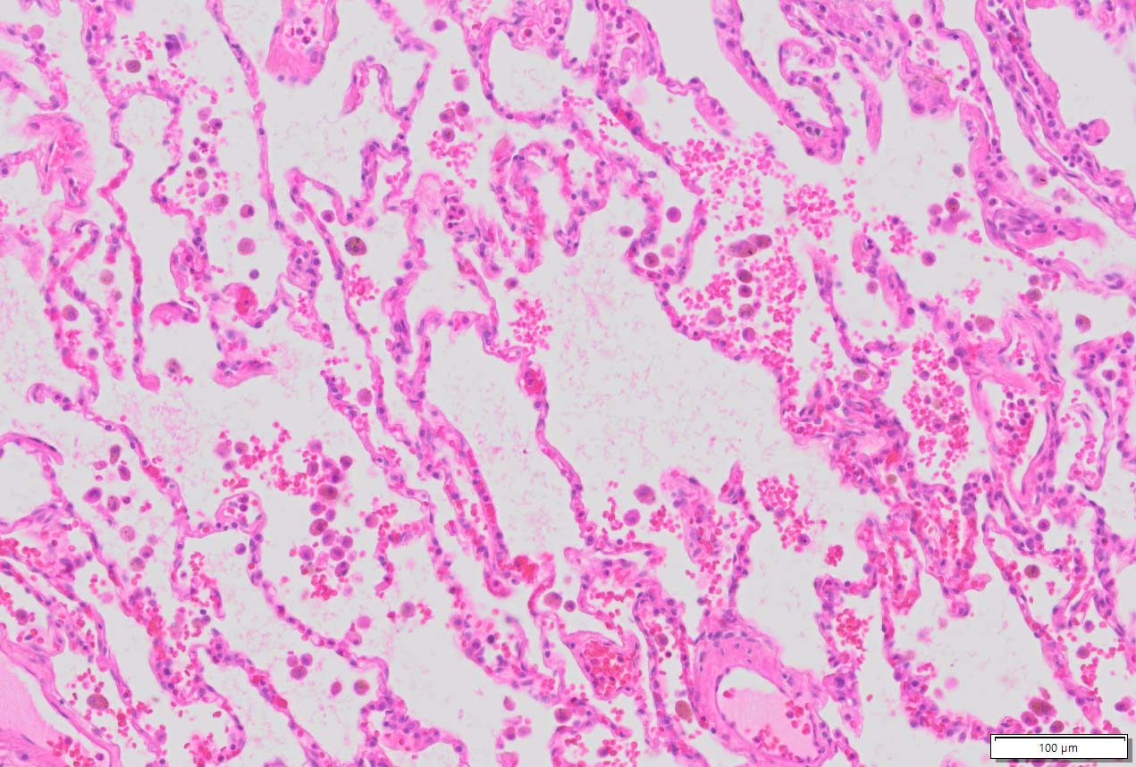 Human Lung Tissue Normal Ffpe Sections