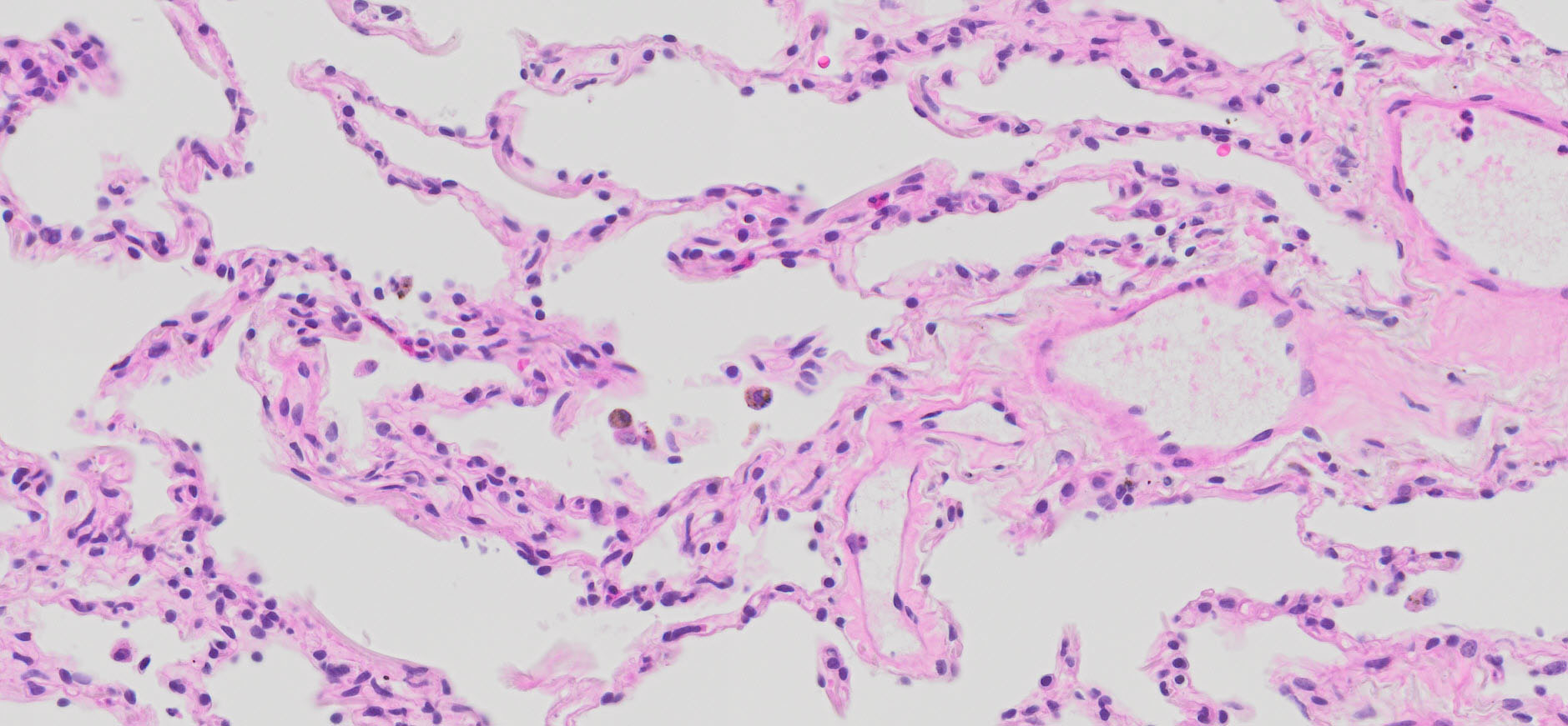 Human Lung Tissue Normal Ffpe Sections