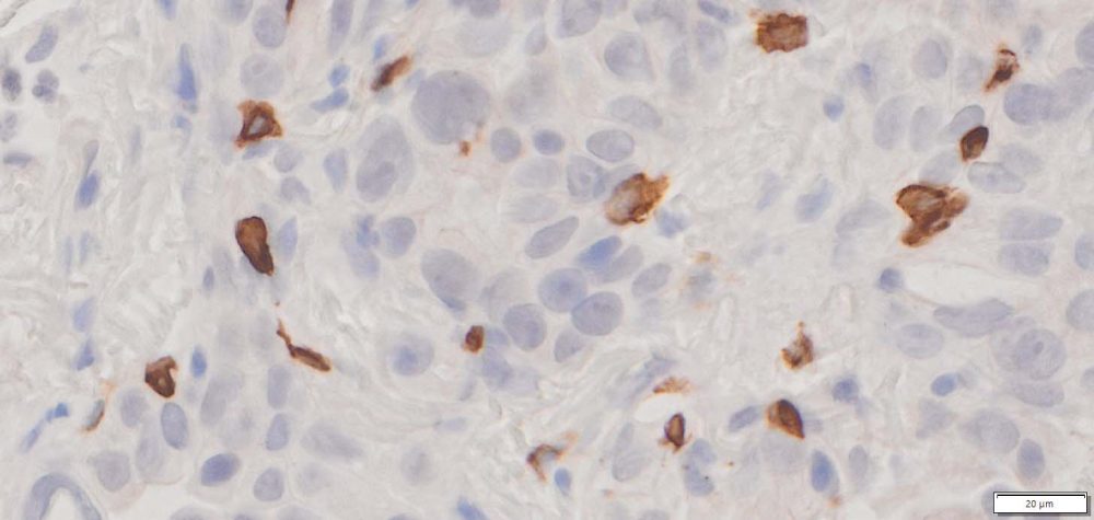 Image for Universal 1-step Polymer-Based IHC kit (anti-Mouse & Rabbit IgG) (100 Slides)