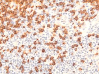 VitroView™ LSAB IHC Kit (Mouse IgG) (150 slides)