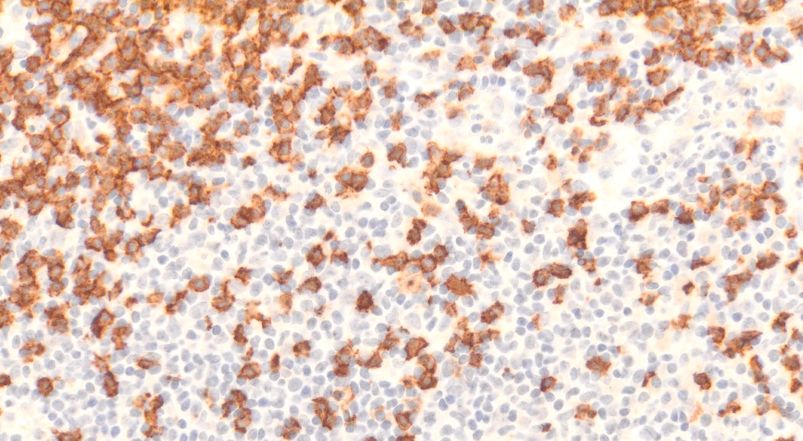 VitroView™ LSAB IHC Kit (Mouse IgG) (100 slides)