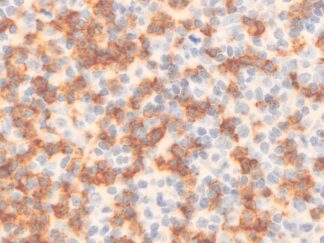 VitroView™ LSAB IHC-DAB Kit (Mouse IgG) (150 slides)