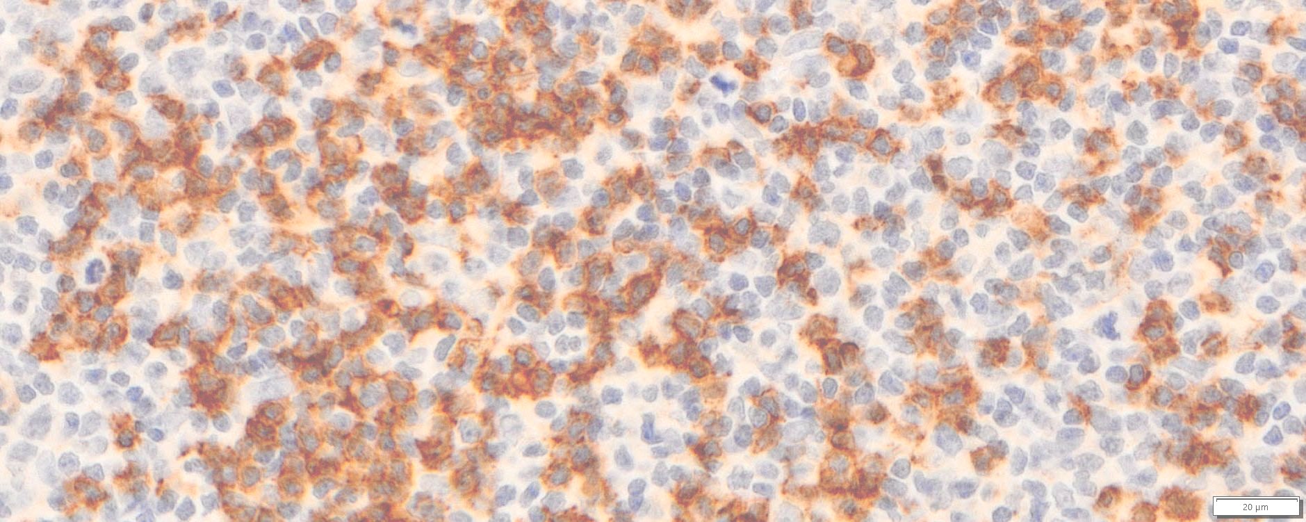 VitroView™ LSAB IHC-DAB Kit (Mouse IgG) (100 slides)