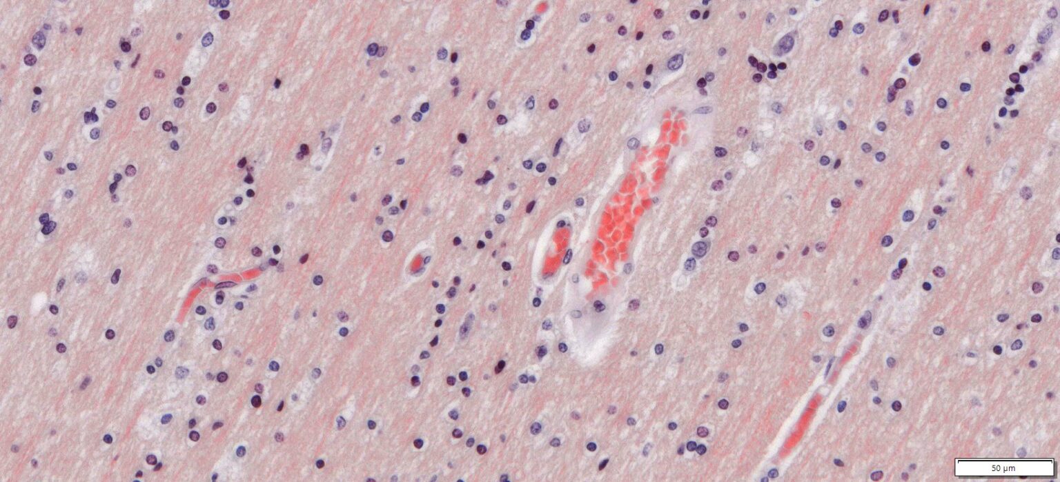 VitroView™ Congo Red Amyloid Stain Kit VitroVivo Biotech