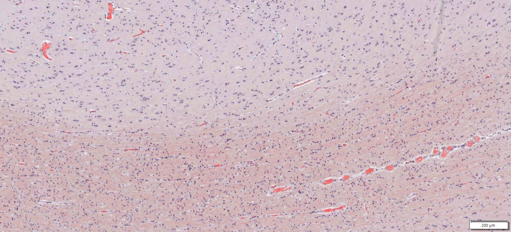 VitroView™ Congo Red Amyloid Stain Kit VitroVivo Biotech
