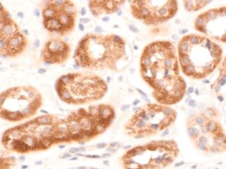 VitroView™ LSAB IHC Kit (Rabbit IgG) (150 slides)