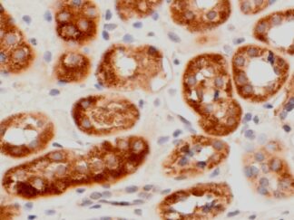 VitroView™ LSAB IHC Kit (Rabbit IgG) (100 slides)