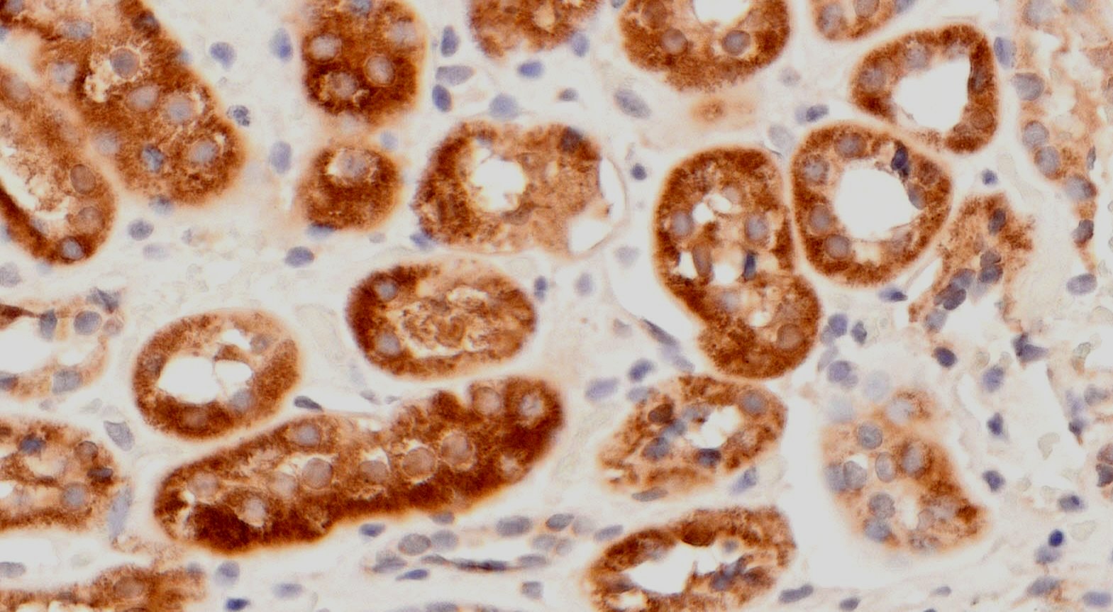 VitroView™ LSAB IHC Kit (Rabbit IgG) (100 slides)