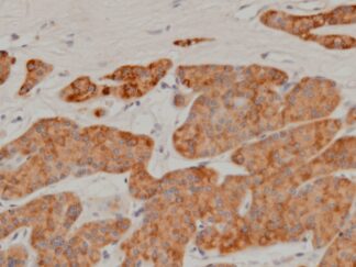 VitroView™ LSAB IHC-DAB Kit (Rabbit IgG) (100 slides)