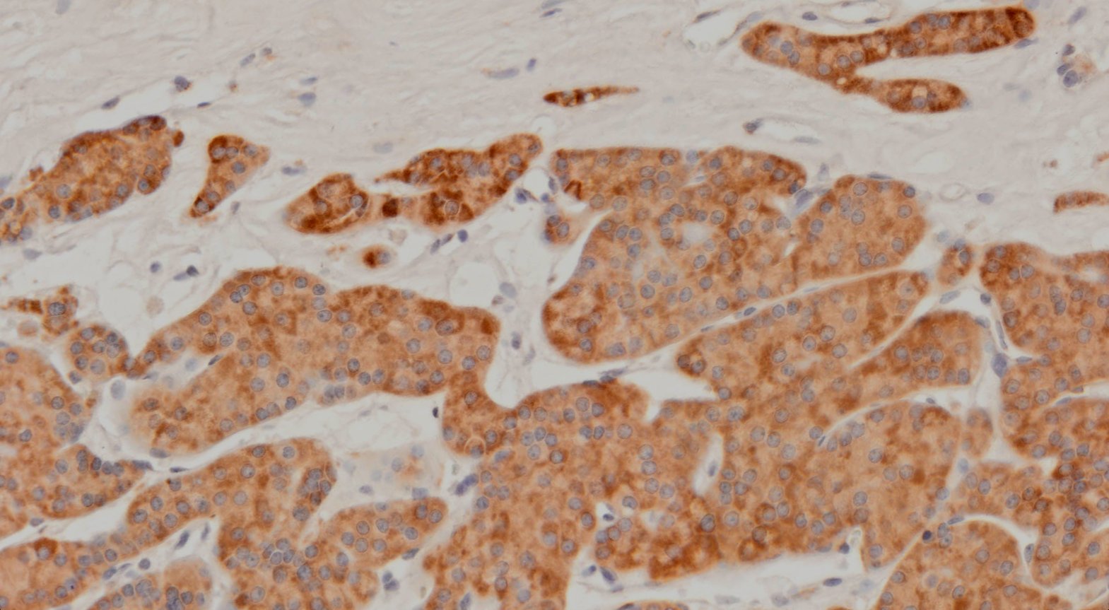 VitroView™ LSAB IHC-DAB Kit (Rabbit IgG) (100 slides)