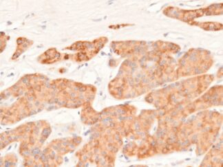 VitroView™ LSAB IHC-DAB Kit (Rabbit IgG) (150 slides)