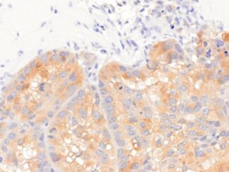VitroView™ LSAB IHC-DAB Kit (Goat IgG) (150 slides)