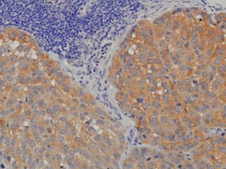 VitroView™ LSAB IHC Kit (Goat IgG) (100 slides)