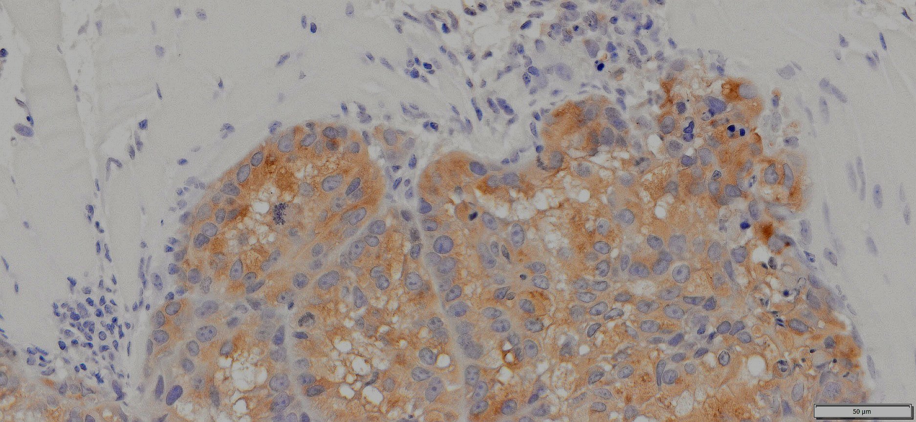 VitroView™ LSAB IHC-DAB Kit (Goat IgG) (100 slides)