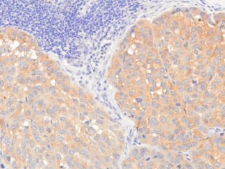 VitroView™ LSAB IHC Kit (Goat IgG) (150 slides)