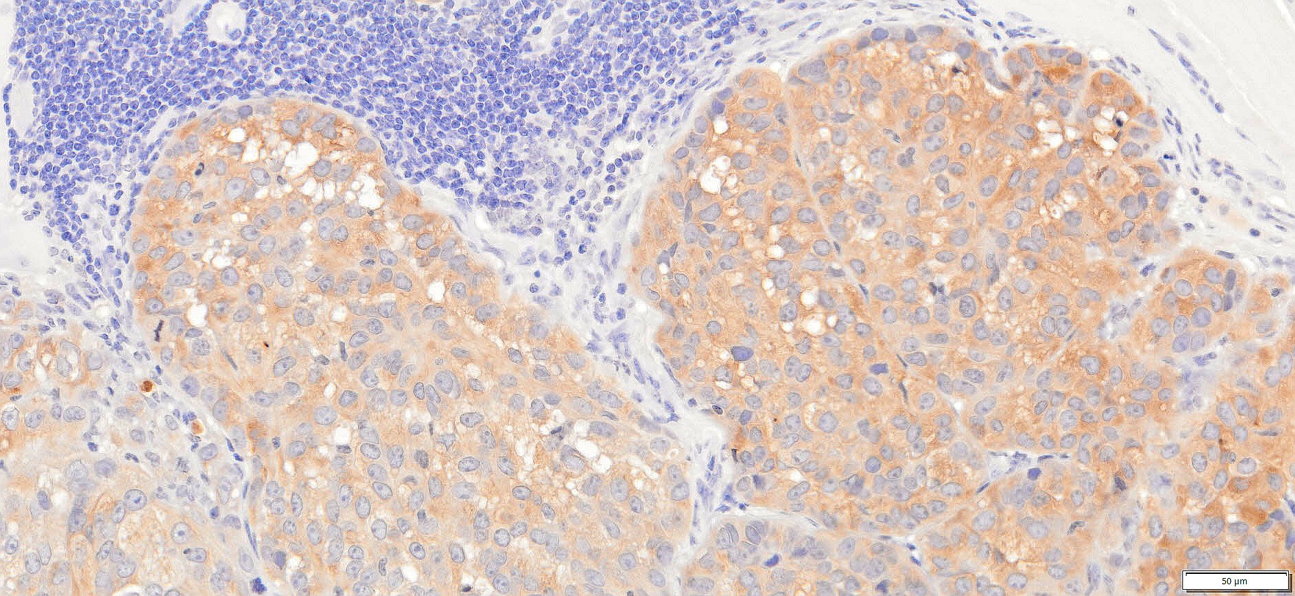 VitroView™ LSAB IHC Kit (Goat IgG) (150 slides)