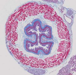 Trichrome Stain for FFPE And Frozen Tissue Slides