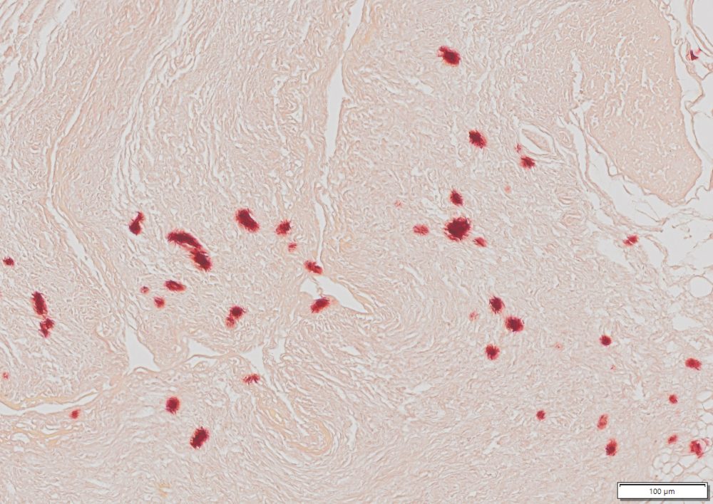 Vitroview™ Alizarin Red Stain Kit Tissue Calcium Staining