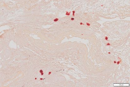 VitroView™ Alizarin Red Stain Kit - Tissue calcium staining