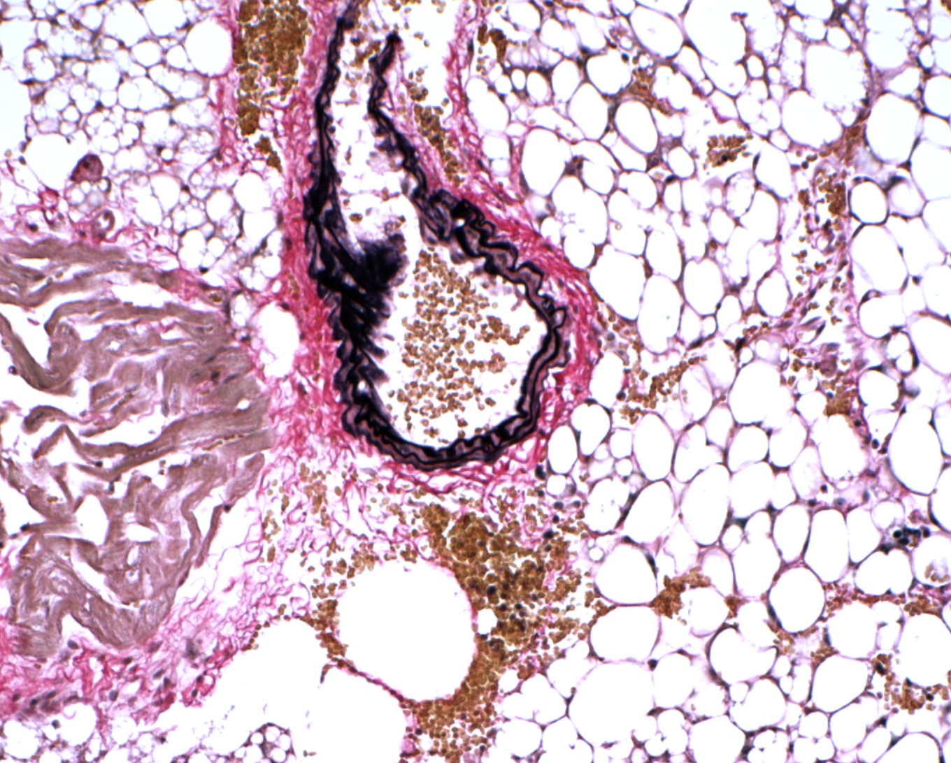 VitroView™ Verhoeff Van Gieson Elastin Stain Kit