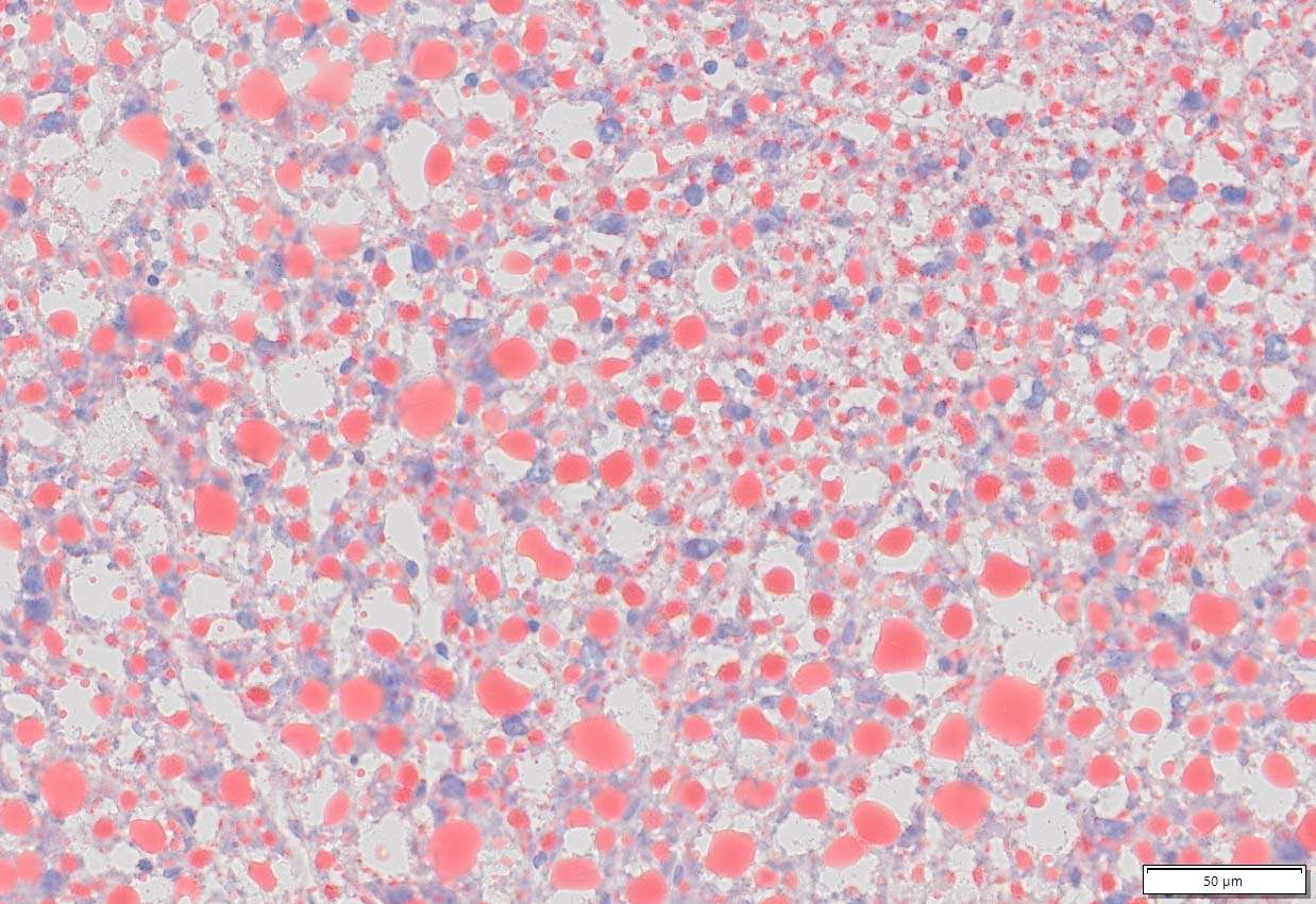 Oil Red O Staining Stain Kit Online