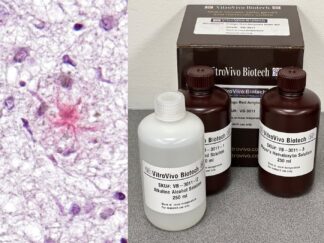 VitroView™ Congo Red Amyloid Stain Kit