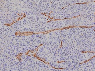 VitroView™ LSAB IHC Kit (Rat IgG) (100 slides)