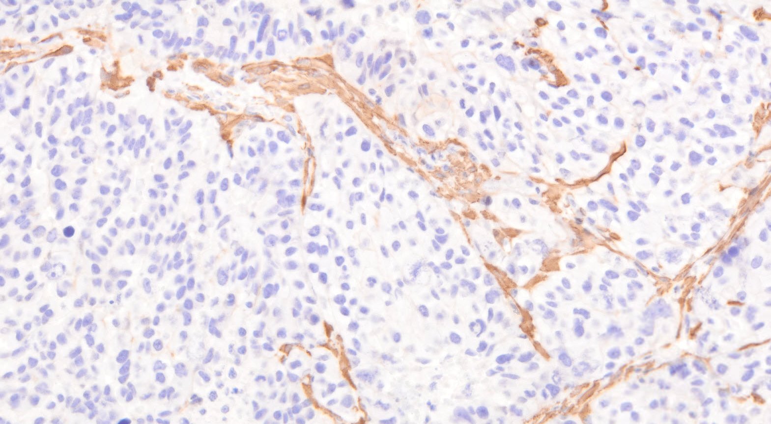 VitroView™ LSAB IHC-DAB Kit (Rat IgG) (150 slides)
