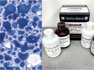VitroView™ Sudan Black B Lipid Stain Kit