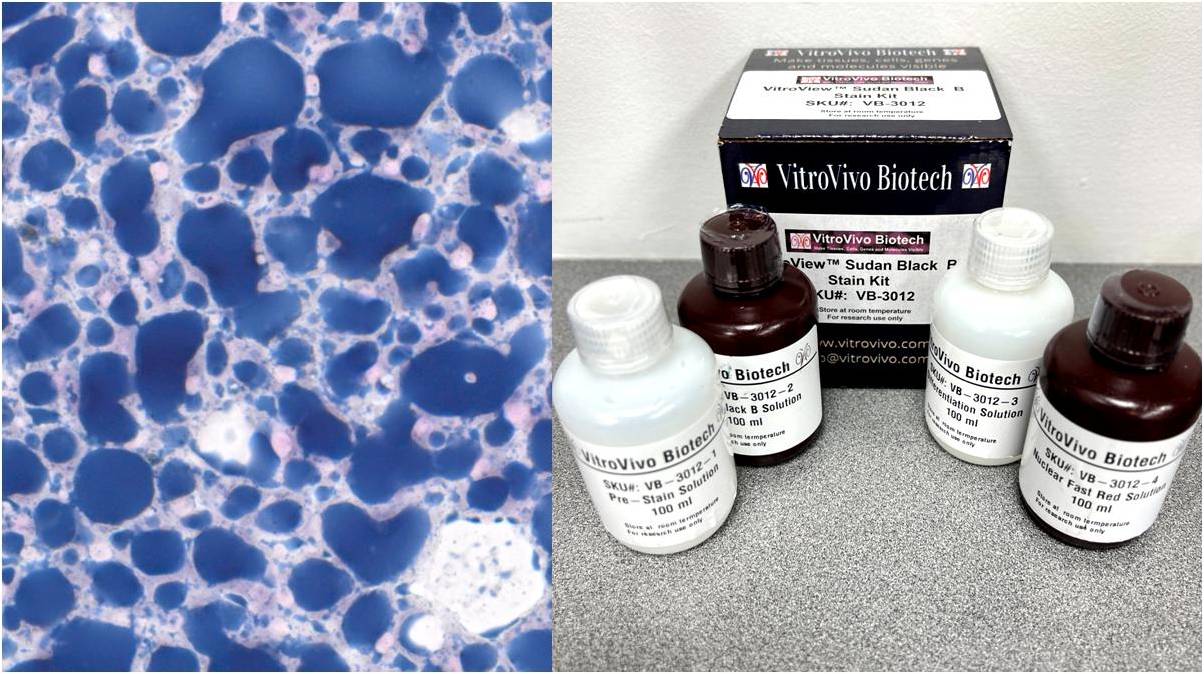 VitroView™ Sudan Black B Lipid Stain Kit