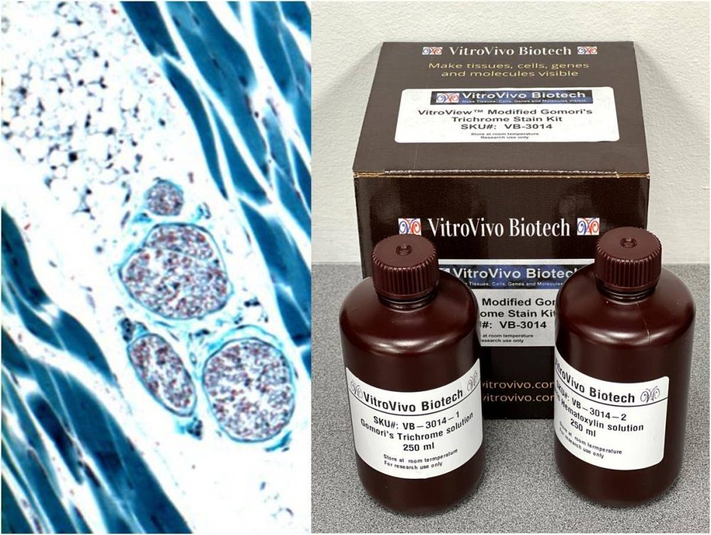 VitroView™ Martius Scarlet Blue (MSB) Stain Kit