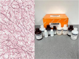 VitroView™ Reticulum Stain Kit