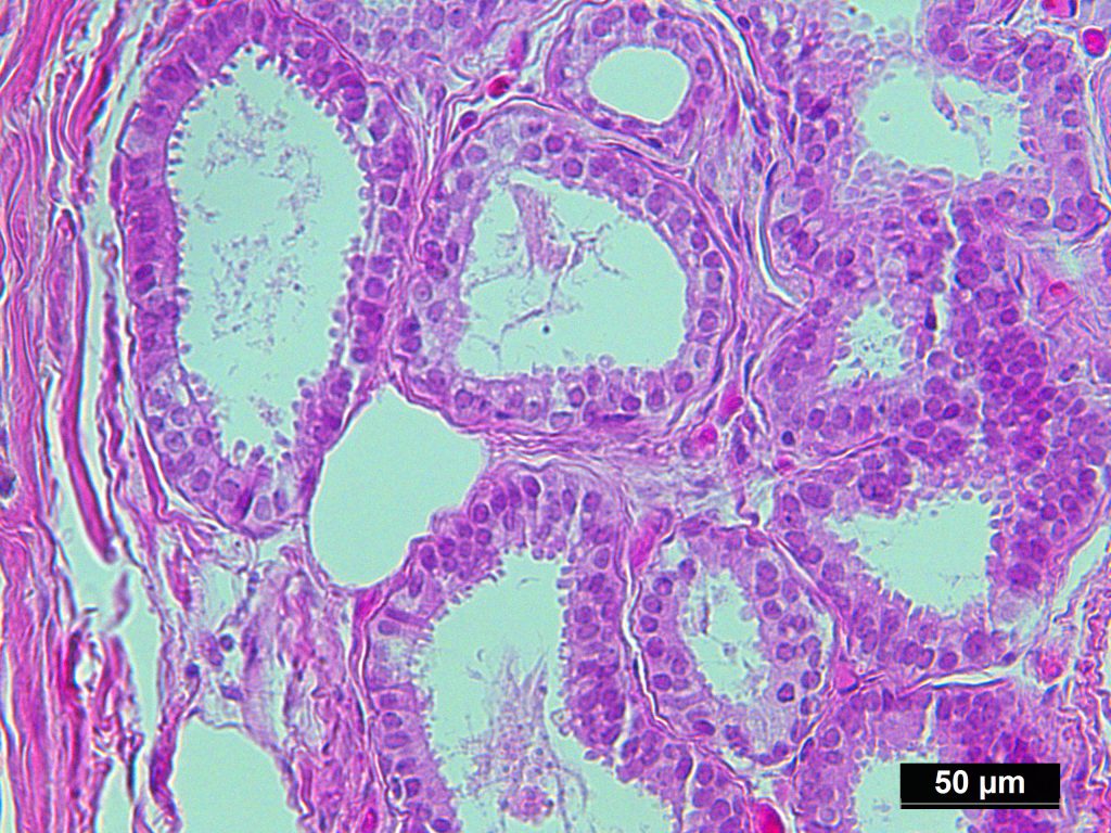 Human Breast Tissue Normal Ffpe Sections 1965