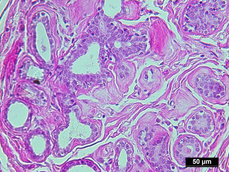 Pure Human Normal Mammary Gland Epithelial Cells Isolated by LCM from ...