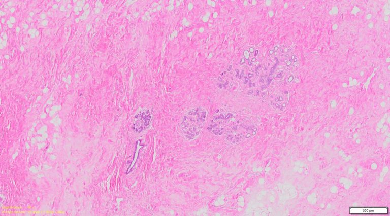 Human Breast Tissue Normal Ffpe Sections 1996