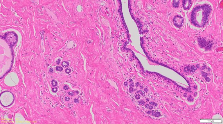 Human Breast Tissue Normal FFPE Sections