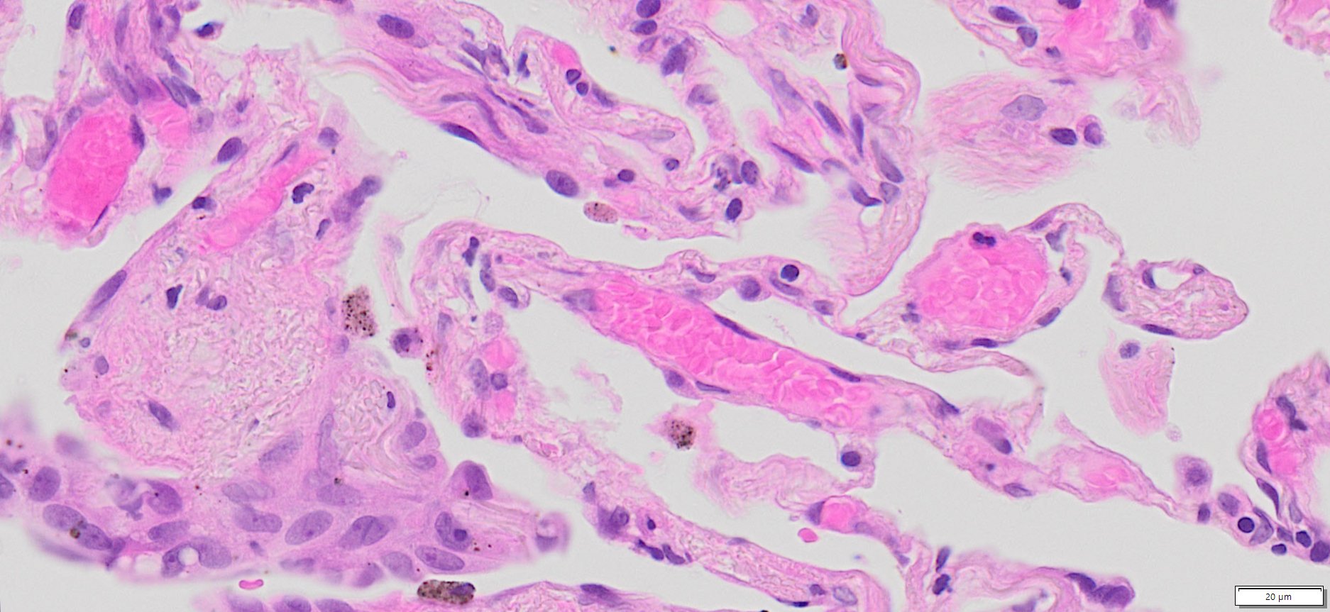 HuPS-03003A1, Human Lung, No-cancer adjacent tissue, H&E, 40x