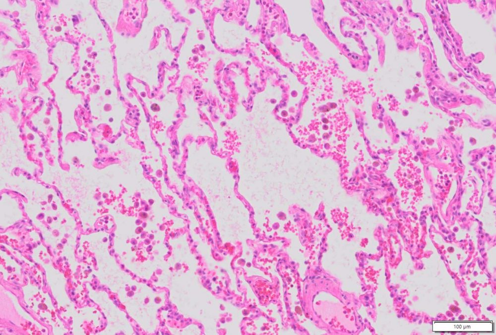 Human Lung Tissue (Normal) FFPE Sections