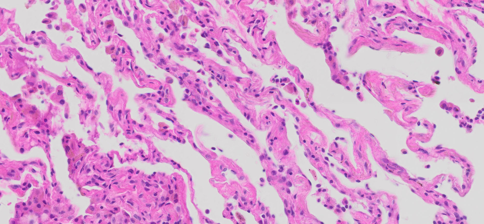 Human Breast Tissue (Normal) FFPE Sections 