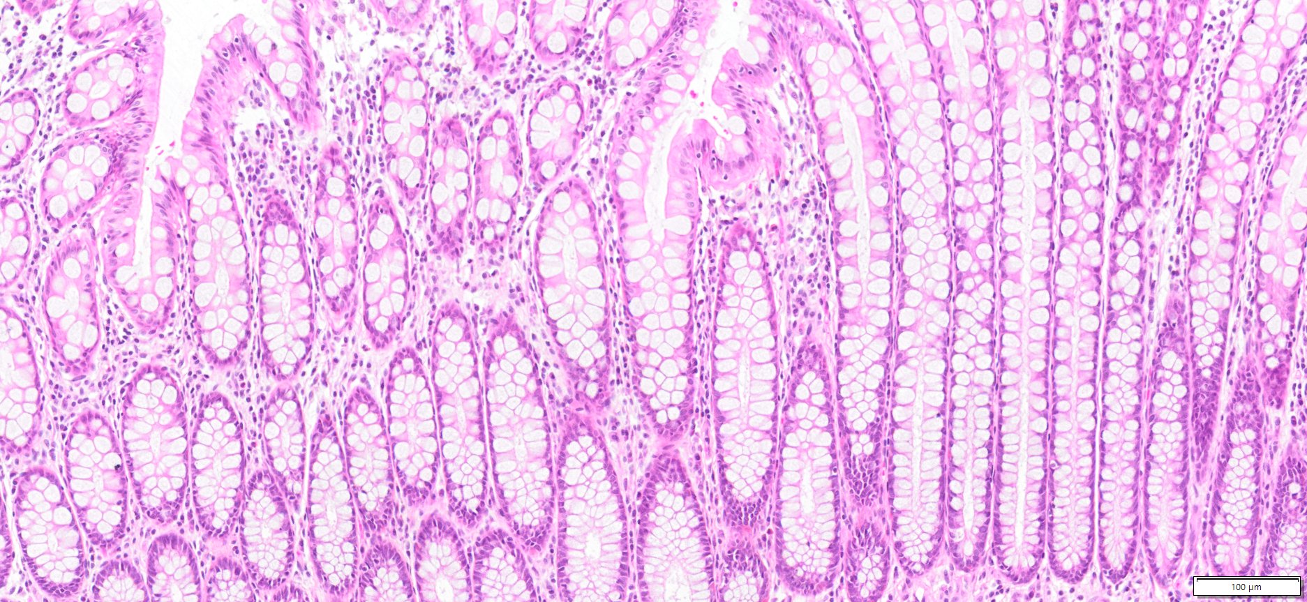 Human Colon Tissue (Normal) FFPE Sections