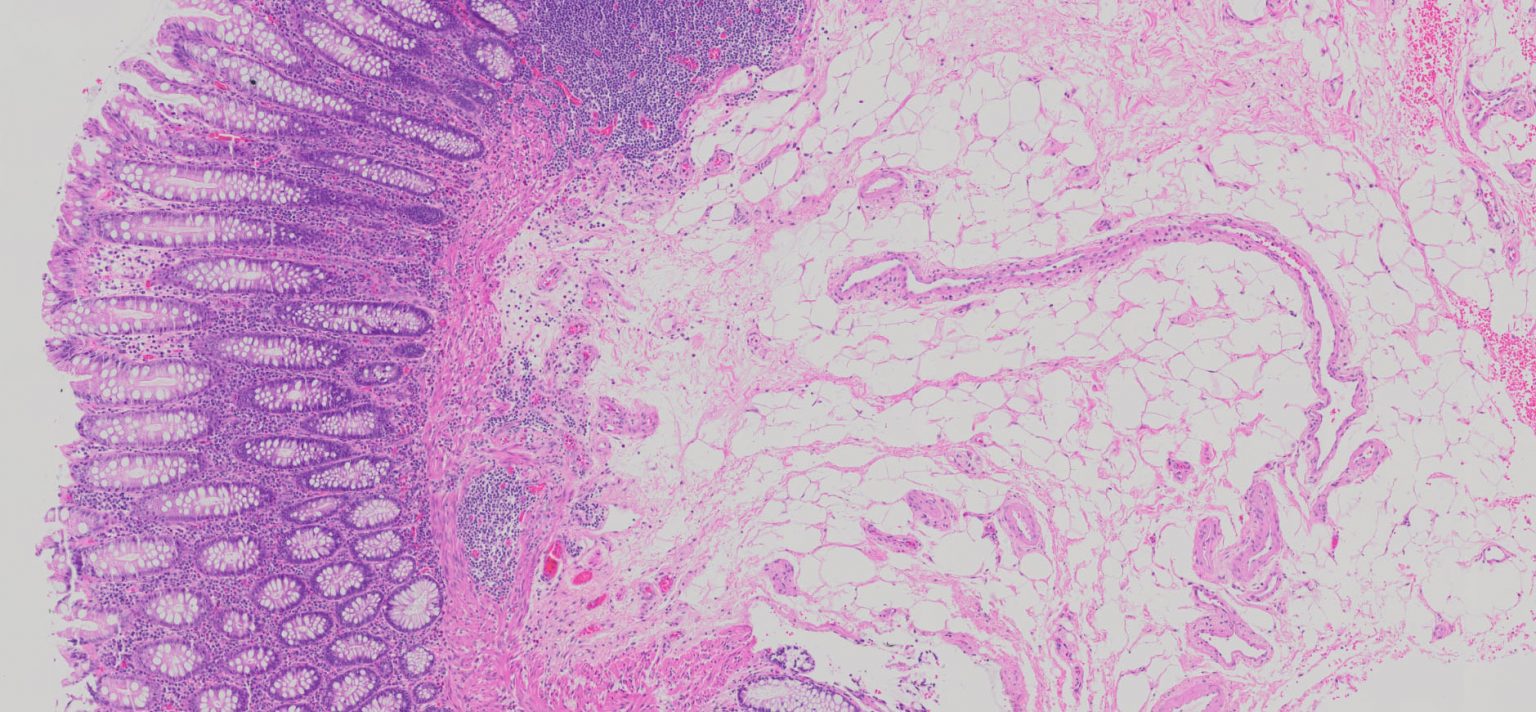 Human Colon Tissue (Normal) FFPE Sections