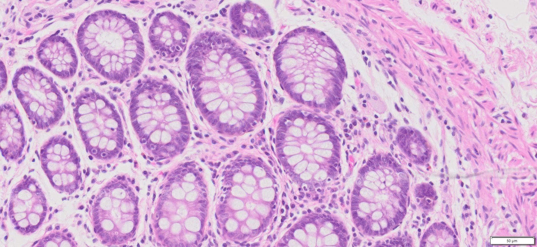 HuPS-07003A Human Colon (Normal), H&E,20x