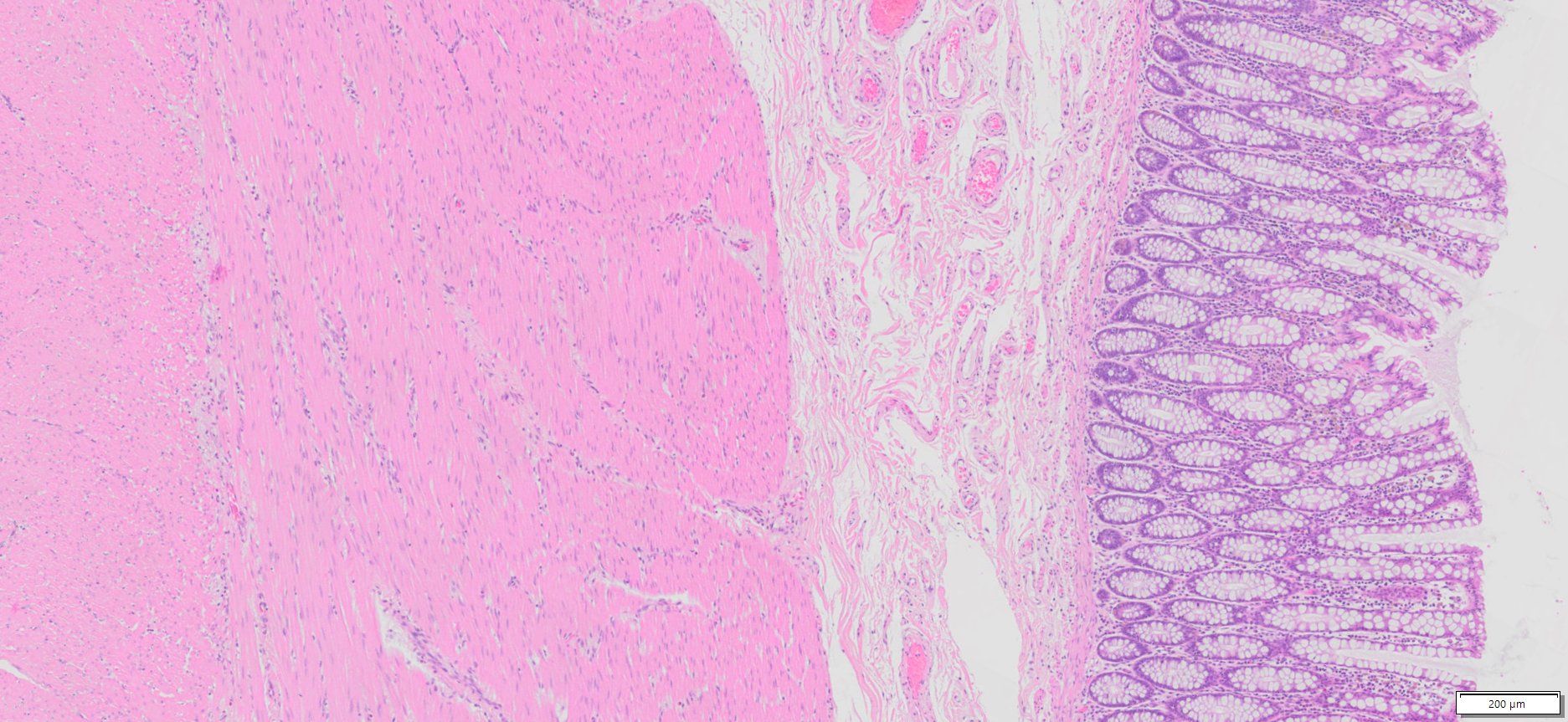 Human Colon Tissue (Normal) FFPE Sections
