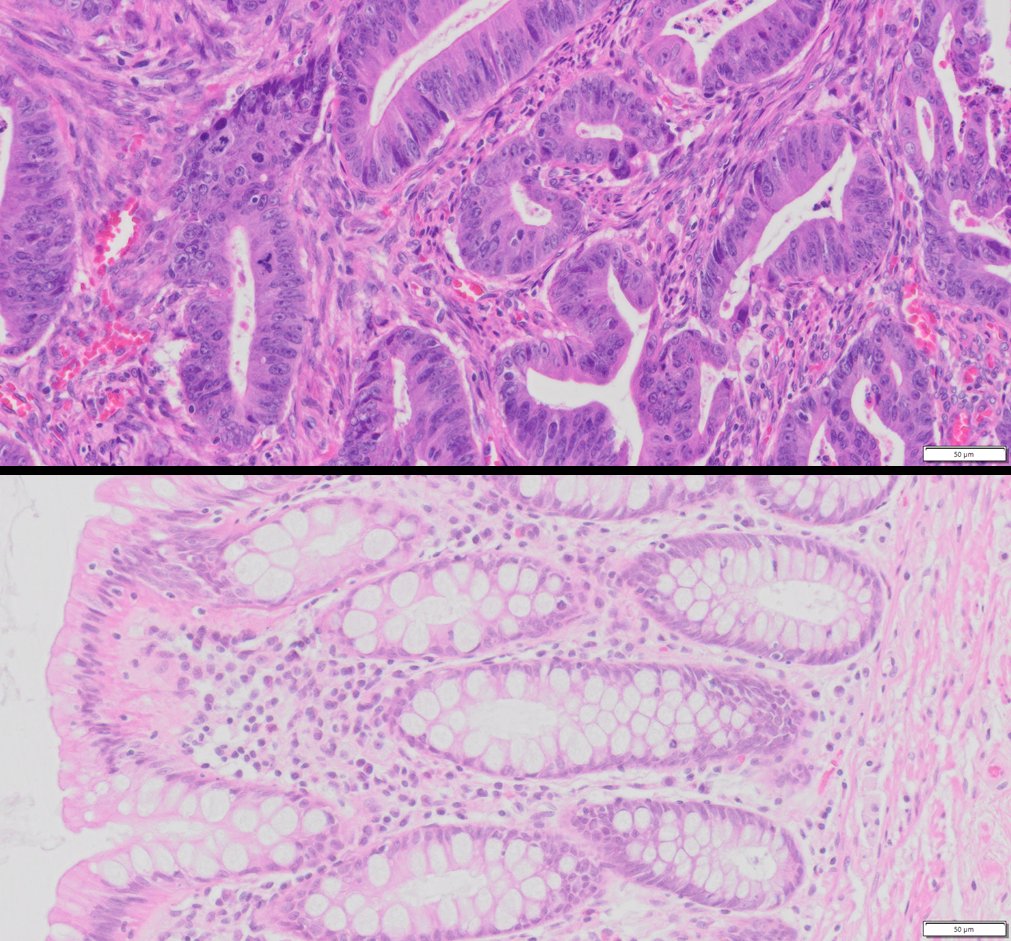 HuPS-07005TA Product Images