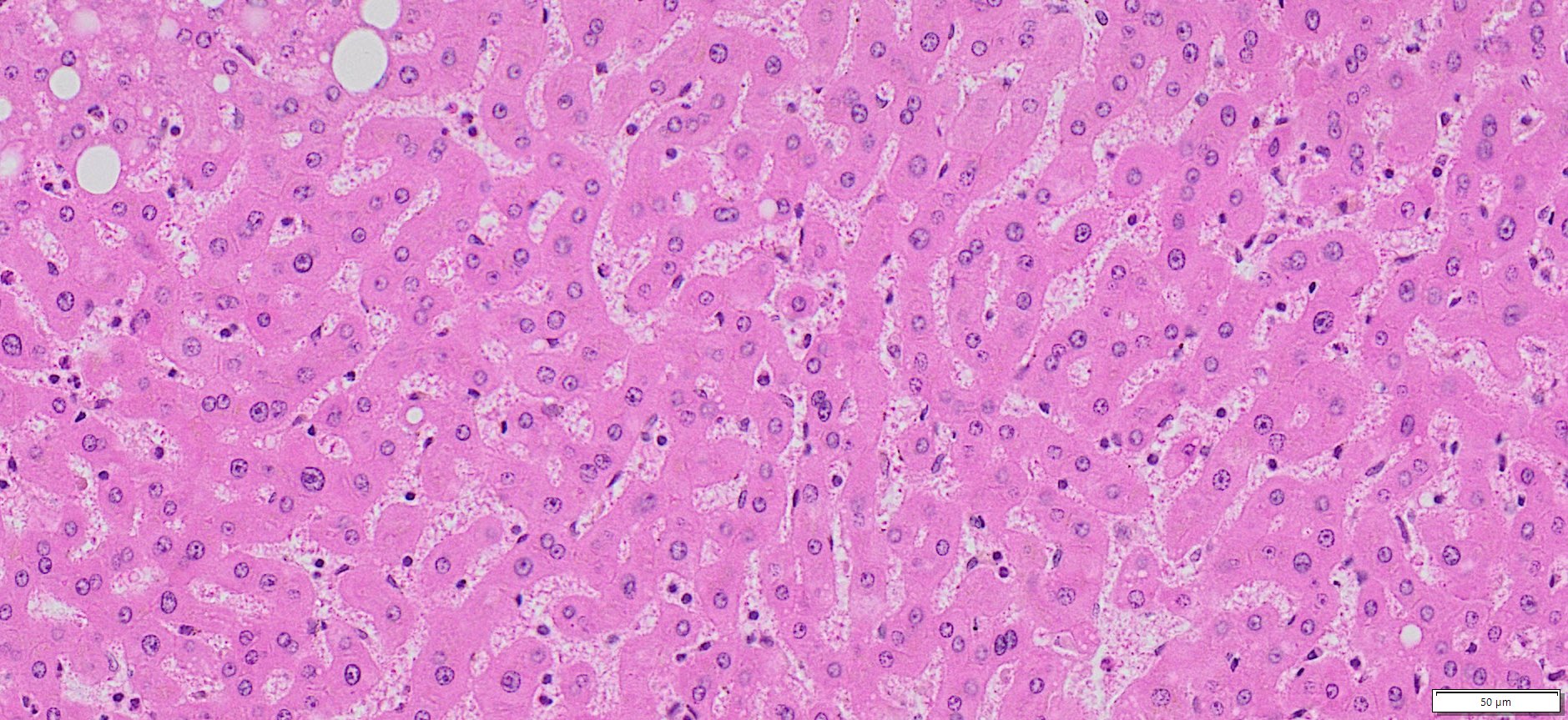 HuPS-080035A Human Liver (normal ) Tissue, H&E, 20x