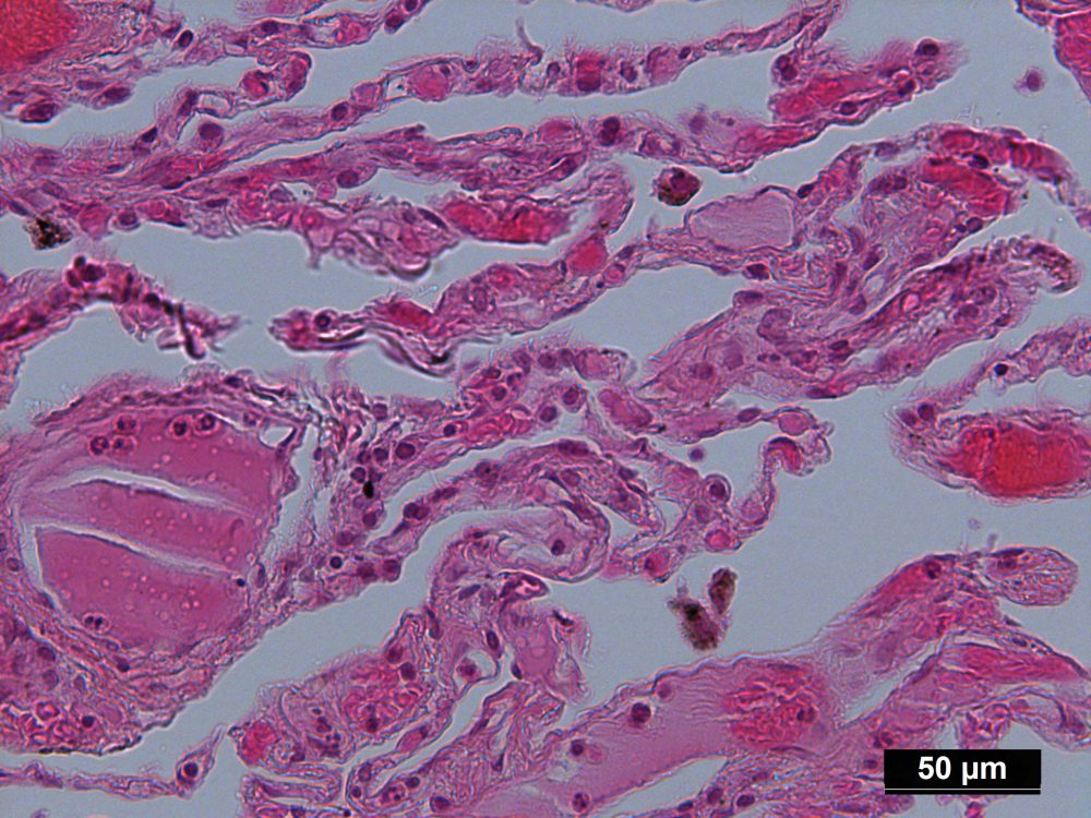 Human Lung Tissue (Normal) FFPE Sections