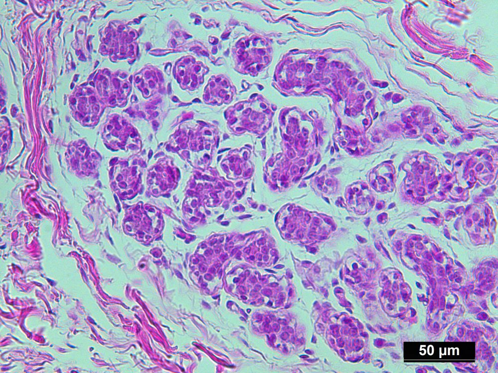 Pure Human Normal Mammary Gland Epithelial Cells Isolated by LCM from ...