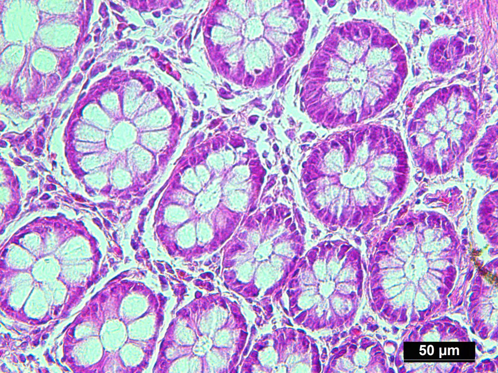 Genomic DNA Extracted from Pure Human Colon Normal Tissue Cells ...